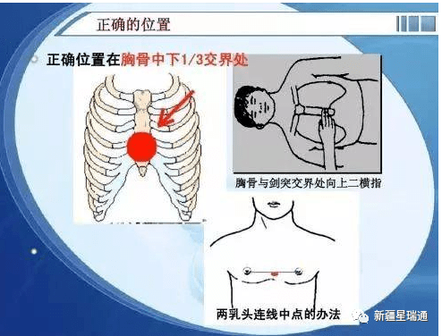 急救医疗小知识(图6)