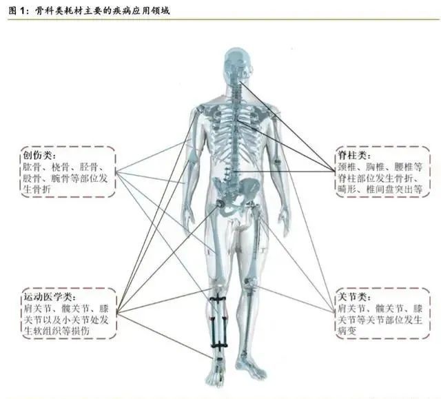 1xbet体育网址骨科疾病市场产品大盘点 医疗器械综述系列